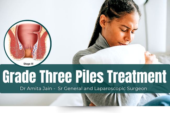 Dr Amita Jain Treatment for Thage Three Piles or Internal Hemorrhoid